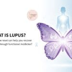 Lupus