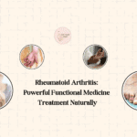 Rheumatoid Arthritis