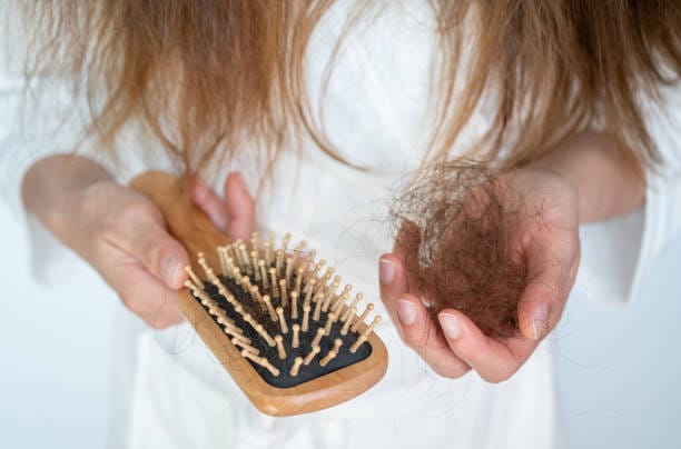 Alopecia