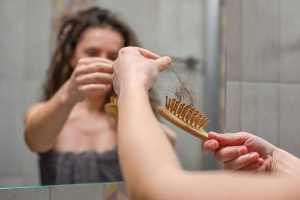 Alopecia
