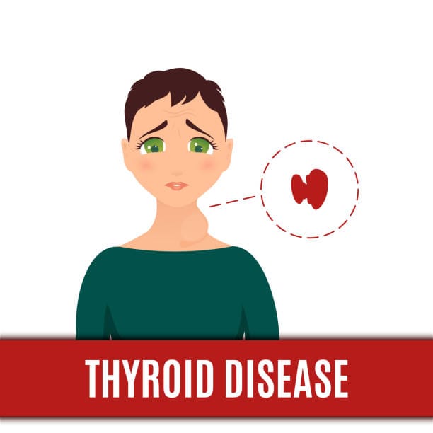 How to Gain Weight with Thyroid Problems: A Comprehensive Guide 2 throid 1