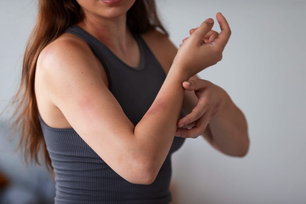 Functional Medicine Approach for Lupus 9 2149561615